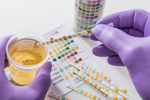 employer urine drug testing